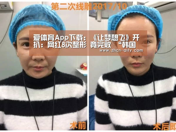 爱体育App下载:《让梦想飞》开扒:网红8次整形 竟完败 “韩国欧巴”(图1) 爱体育App下载